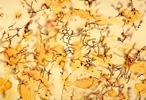 Forr�s:http://pathmicro.med.sc.edu/trepo.jpg